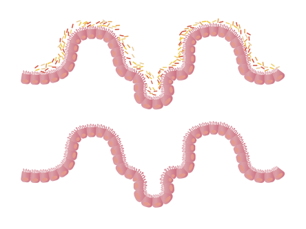 intestines-1468807_1280.png